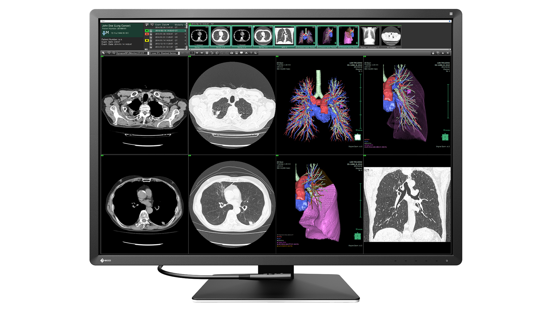 EIZO RadiForce RX1270 31' 31' 31' 31' IPS IPS IPS IPS 4200 x 2800 pixel 4200 x 2800 pixel 4200 x 2800 pixel 4200 x 2800 pixel HDMI DisplayPort HDMI DisplayPort